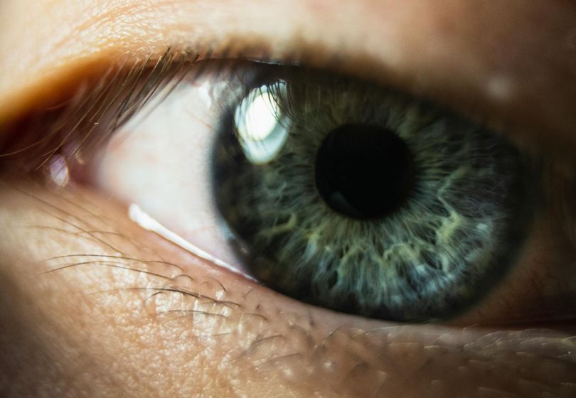 Best Non-Surgical Eyelid Lift Solutions in 2026